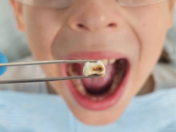 Best Mobile Emergency Dentist in Elm Springs, AR